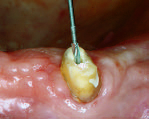 Использование корневого бора 180.19.150